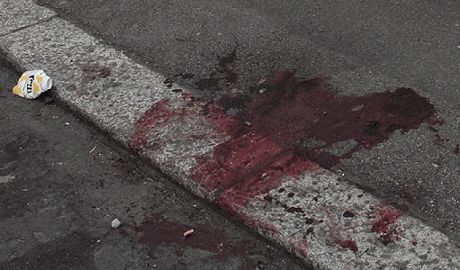 Кавказцы, прямо на глазах у детей, зверски избили битами троих нижегородцев ФОТО